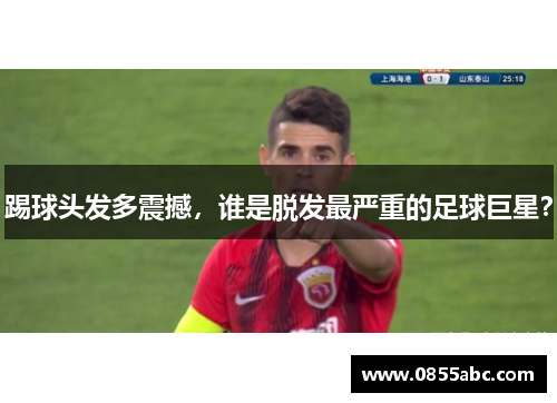 踢球头发多震撼，谁是脱发最严重的足球巨星？